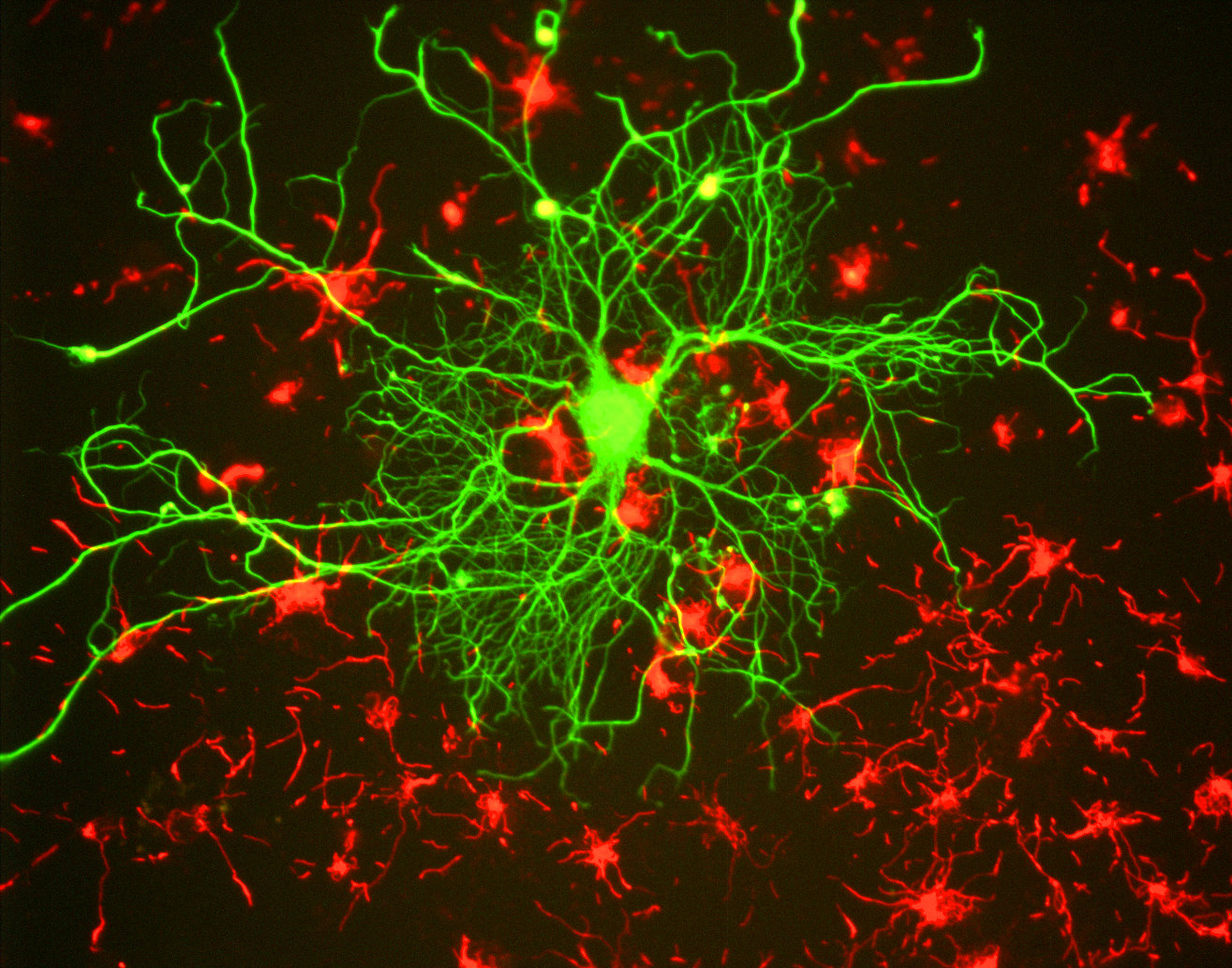 réseau neuronal et liens synaptiques entre les neurones.